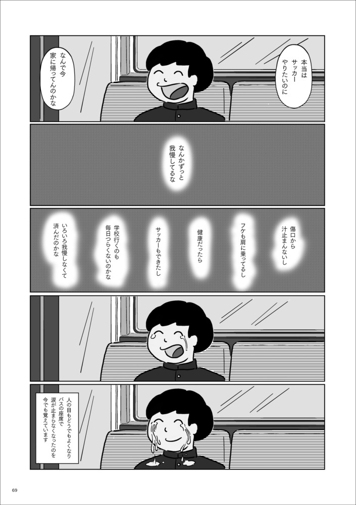 【漫画】ひどいアレルギー症状に悩まされてきた芸人・ちびシャトル